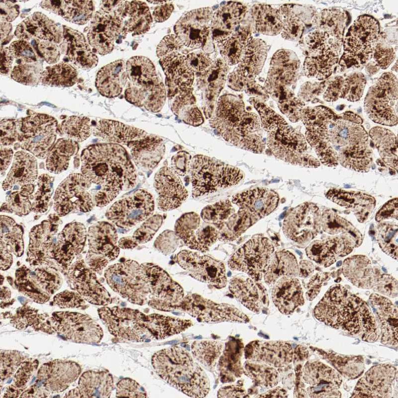 Atlas Antibodies Anti-NDUFB8 Antibody