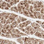 Atlas Antibodies Anti-NDUFB8 Antibody