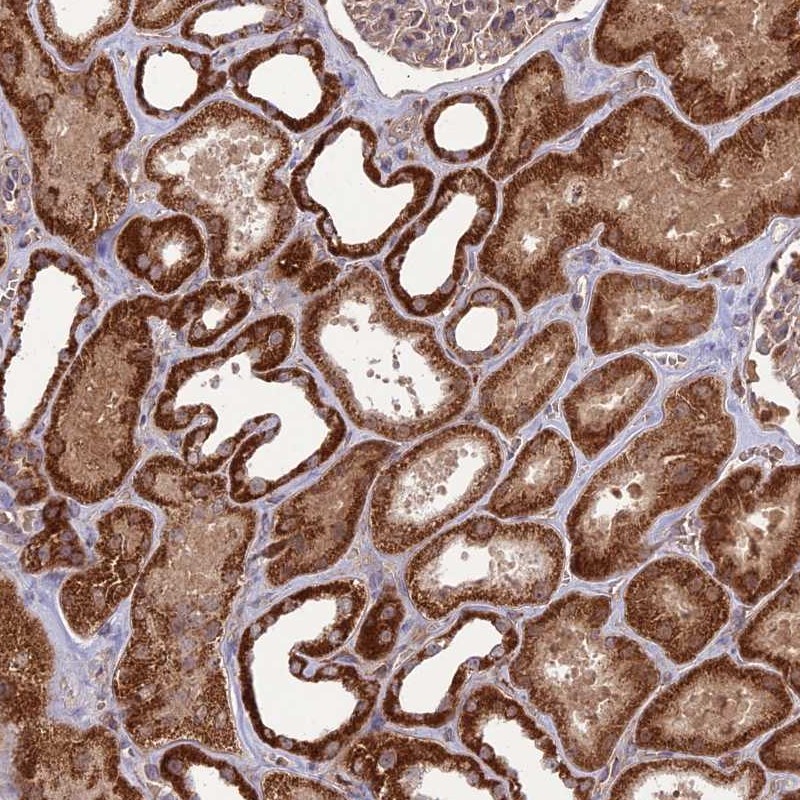 Atlas Antibodies Anti-NDUFC1 Antibody