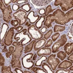 Atlas Antibodies Anti-NDUFC1 Antibody