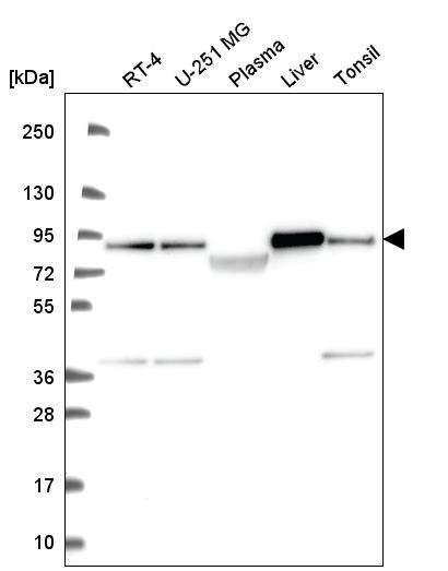 Atlas Antibodies Anti-NDUFS1 Antibody