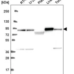 Atlas Antibodies Anti-NDUFS1 Antibody