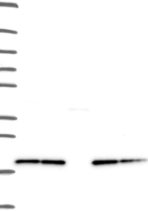 Atlas Antibodies Anti-NDUFB8 Antibody