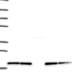 Atlas Antibodies Anti-NDUFB8 Antibody
