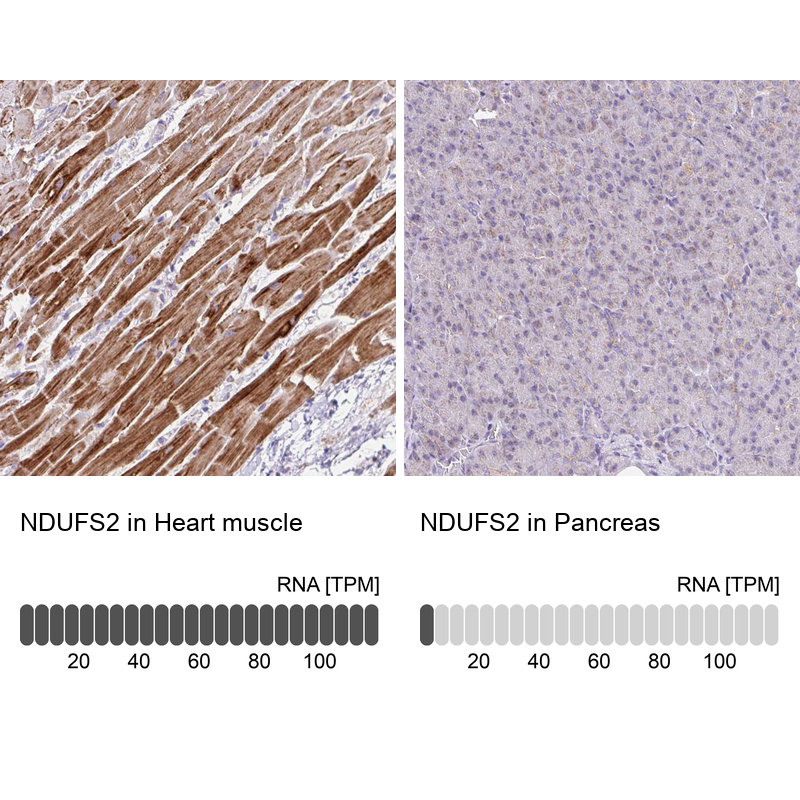 Atlas Antibodies Anti-NDUFS2 Antibody