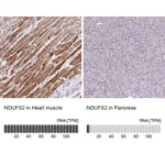 Atlas Antibodies Anti-NDUFS2 Antibody
