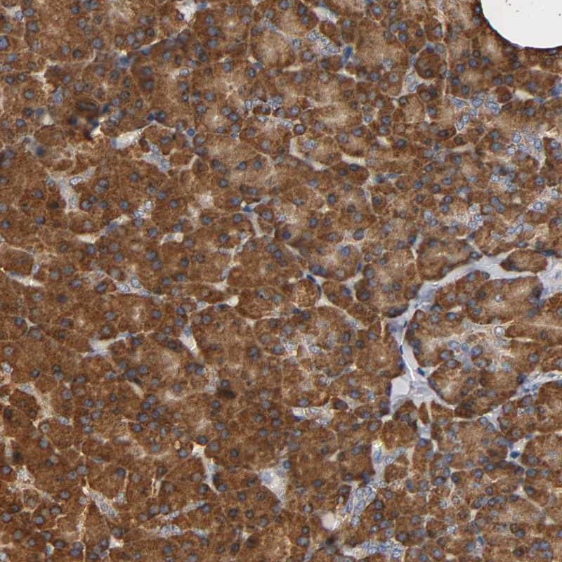 Atlas Antibodies Anti-NDUFS3 Antibody