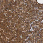 Atlas Antibodies Anti-NDUFS3 Antibody