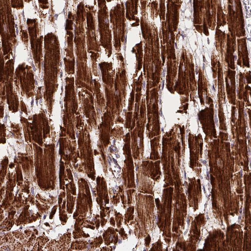 Atlas Antibodies Anti-NDUFS2 Antibody
