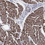 Atlas Antibodies Anti-NDUFS8 Antibody