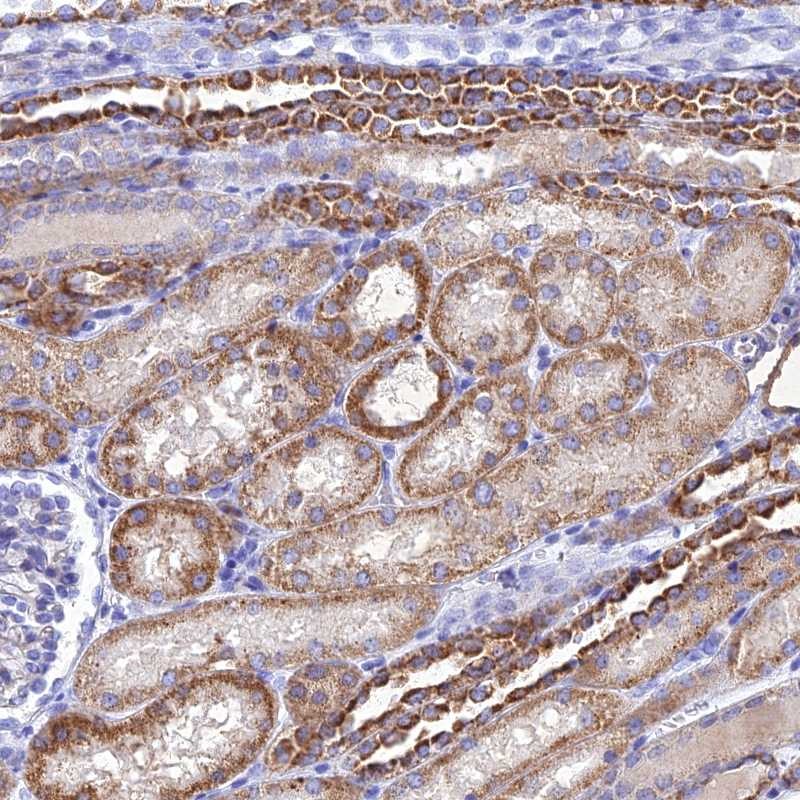 Atlas Antibodies Anti-NDUFV1 Antibody