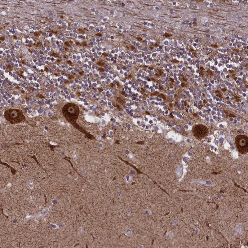 Atlas Antibodies Anti-NDUFS5 Antibody