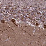 Atlas Antibodies Anti-NDUFS5 Antibody