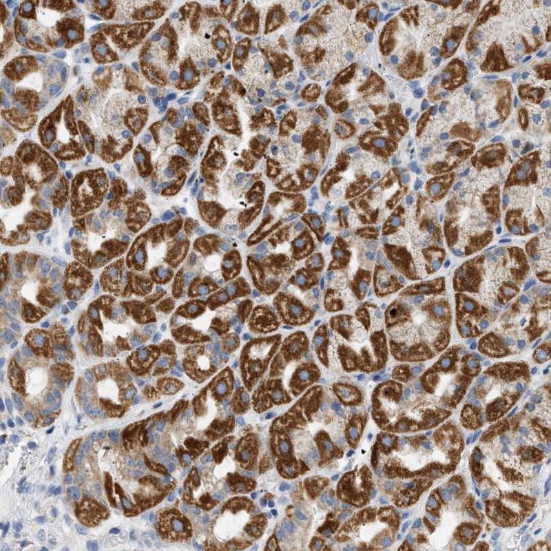 Atlas Antibodies Anti-NDUFS8 Antibody