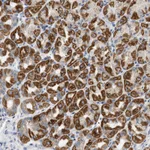 Atlas Antibodies Anti-NDUFS8 Antibody