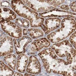 Atlas Antibodies Anti-NDUFS4 Antibody