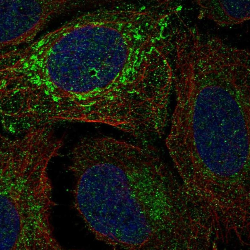 Atlas Antibodies Anti-NDUFV2 Antibody
