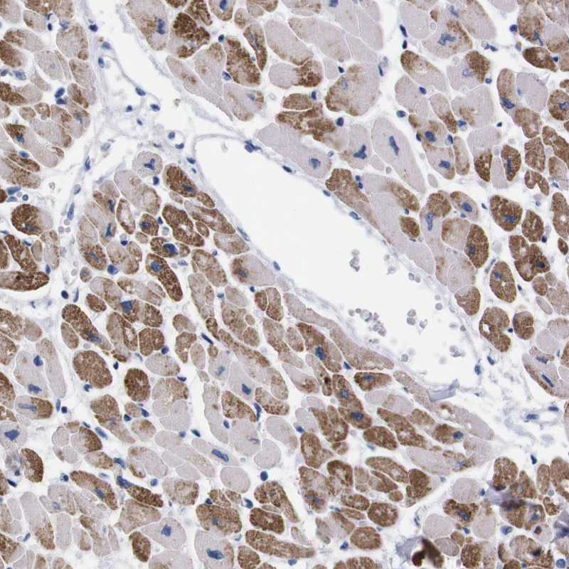 Atlas Antibodies Anti-NEBL Antibody