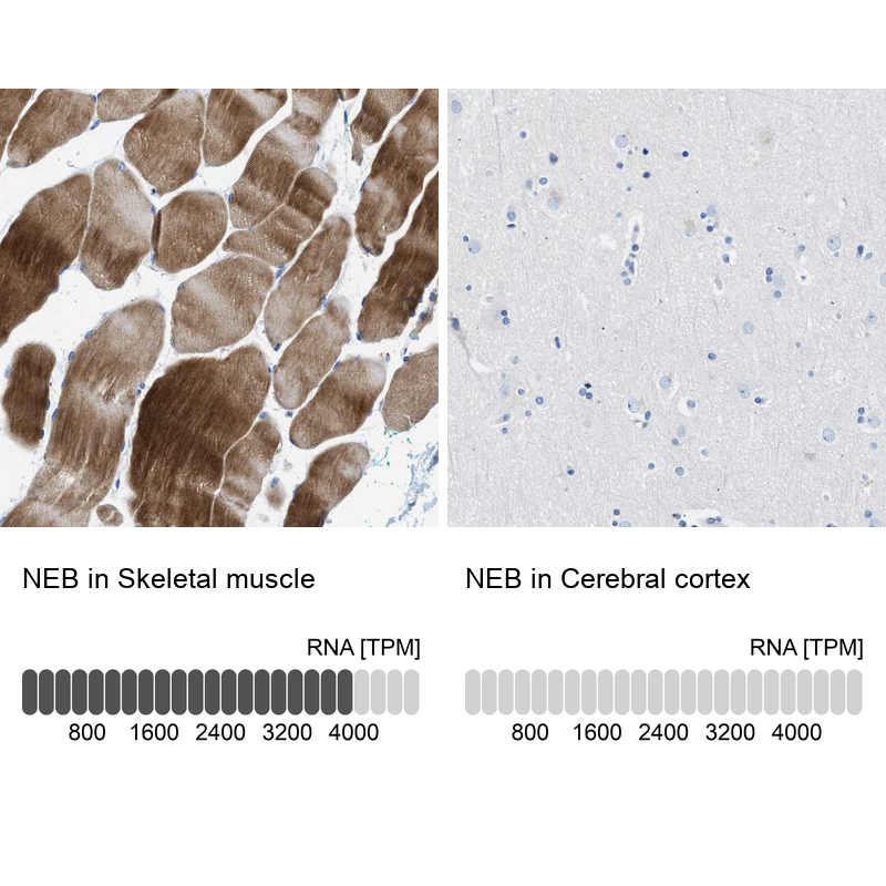 Atlas Antibodies Anti-NEB Antibody