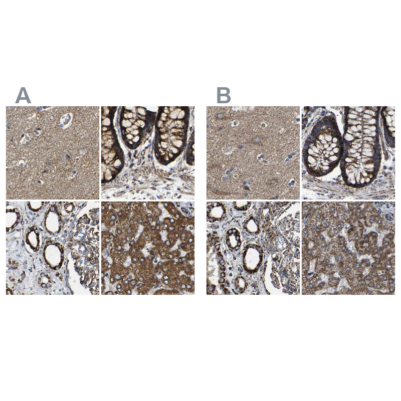 Atlas Antibodies Anti-NDUFV3 Antibody
