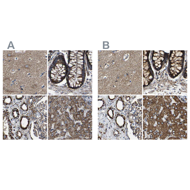 Atlas Antibodies Anti-NDUFV3 Antibody