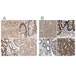 Atlas Antibodies Anti-NDUFV3 Antibody