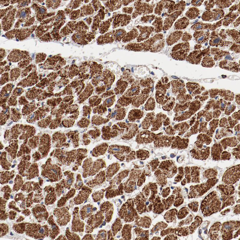 Atlas Antibodies Anti-NDUFV2 Antibody