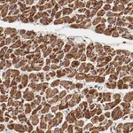 Atlas Antibodies Anti-NDUFV2 Antibody