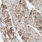 Atlas Antibodies Anti-NEBL Antibody