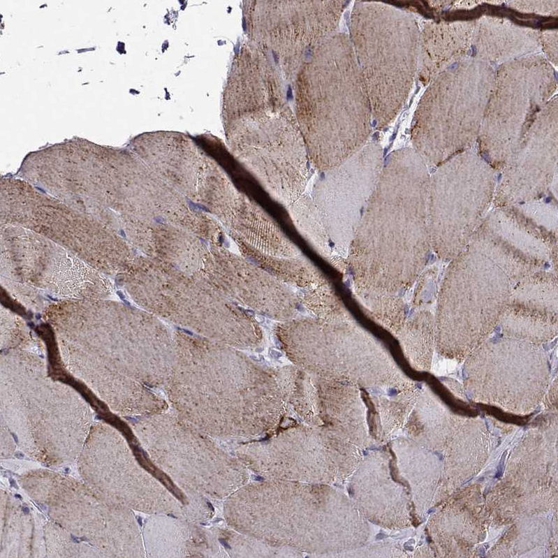 Atlas Antibodies Anti-NECAB3 Antibody