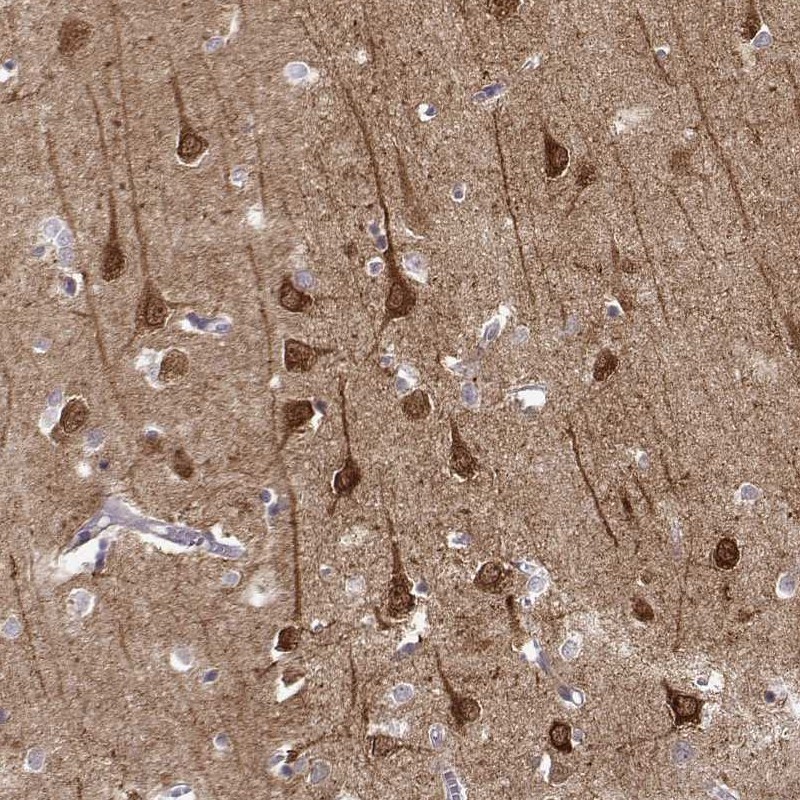 Atlas Antibodies Anti-NECAB3 Antibody
