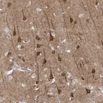 Atlas Antibodies Anti-NECAB3 Antibody