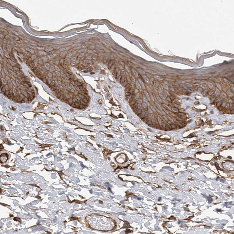 Atlas Antibodies Anti-NECTIN1 Antibody