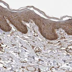 Atlas Antibodies Anti-NECTIN1 Antibody