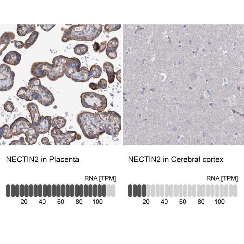 Atlas Antibodies Anti-NECTIN2 Antibody
