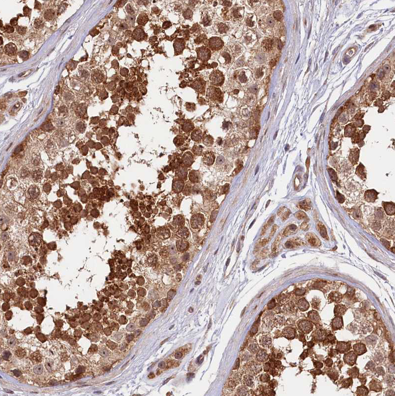 Atlas Antibodies Anti-NEDD1 Antibody
