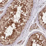 Atlas Antibodies Anti-NEDD1 Antibody