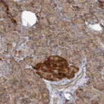 Atlas Antibodies Anti-NEDD4L Antibody