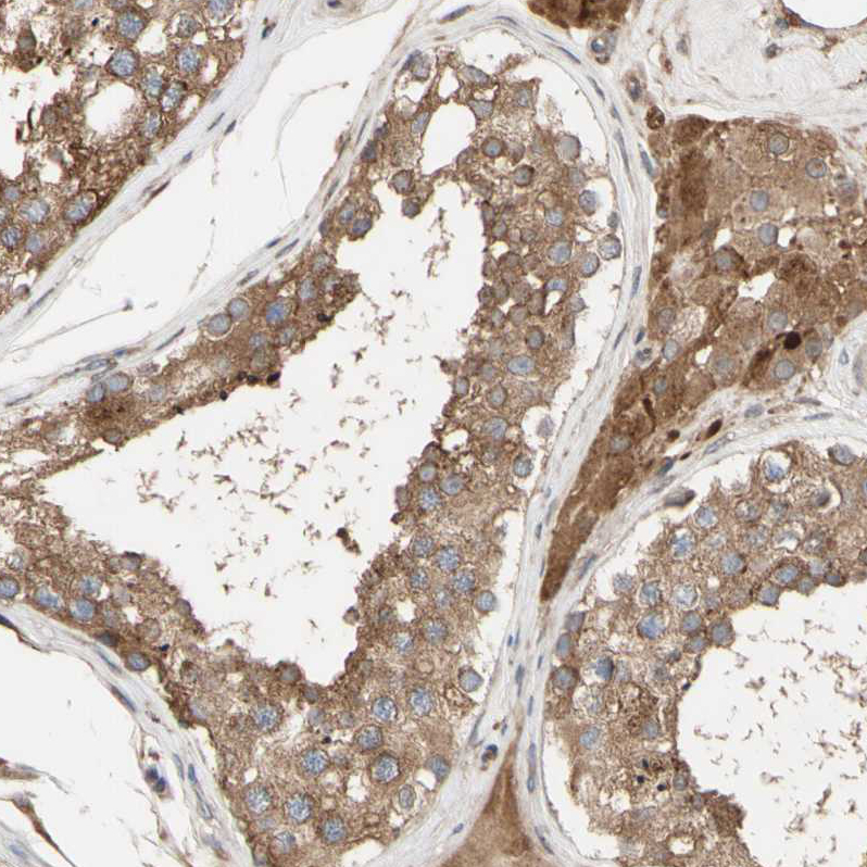 Atlas Antibodies Anti-NECTIN3 Antibody