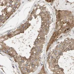 Atlas Antibodies Anti-NECTIN3 Antibody