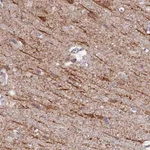 Atlas Antibodies Anti-NEDD4 Antibody