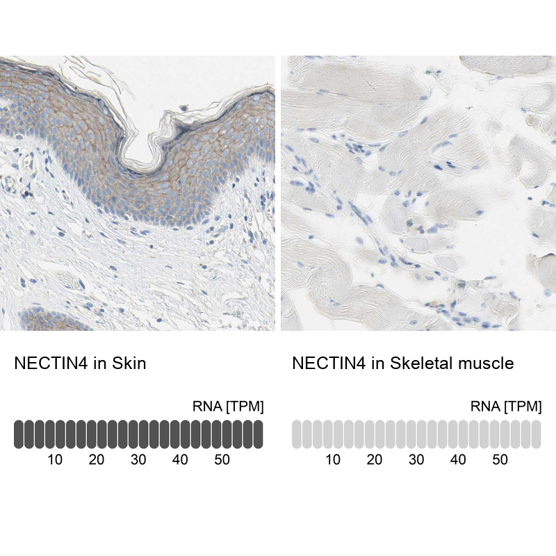 Atlas Antibodies Anti-NECTIN4 Antibody