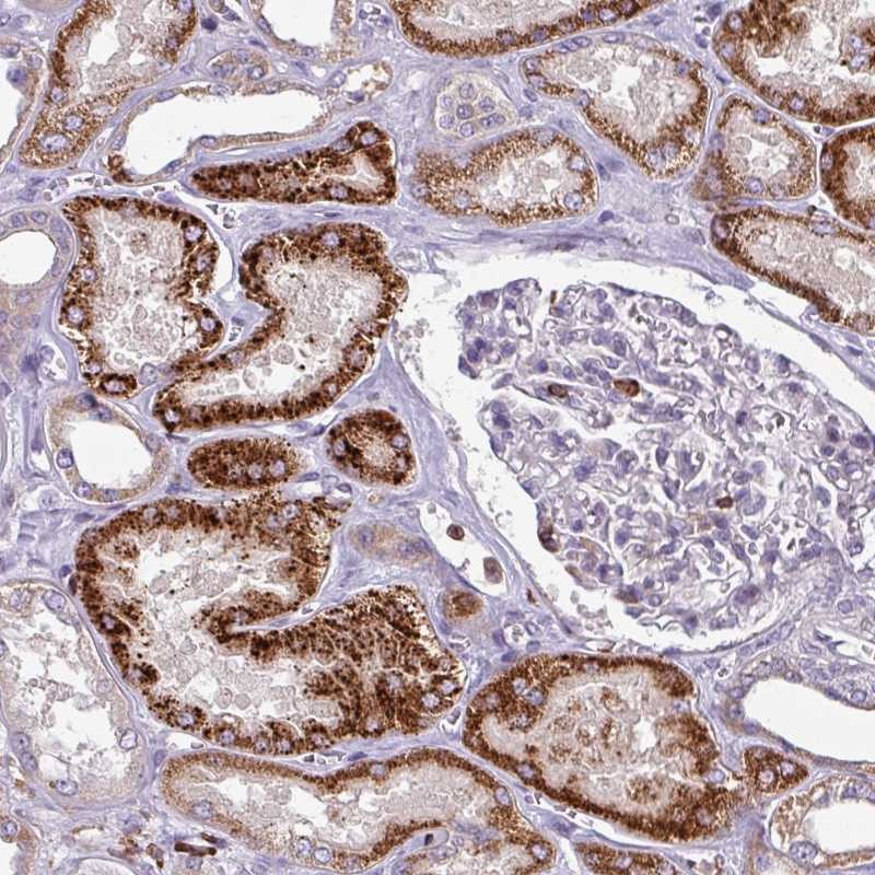 Atlas Antibodies Anti-NEDD9 Antibody