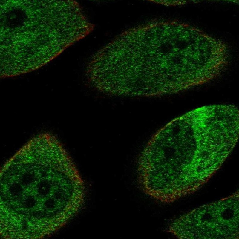 Atlas Antibodies Anti-NEFL Antibody