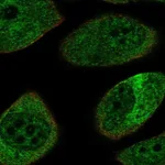 Atlas Antibodies Anti-NEFL Antibody
