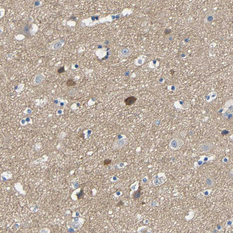 Atlas Antibodies Anti-NEGR1 Antibody
