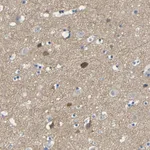 Atlas Antibodies Anti-NEGR1 Antibody