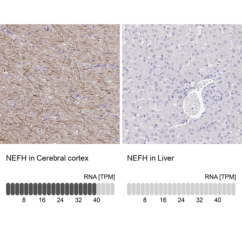 Atlas Antibodies Anti-NEFH Antibody