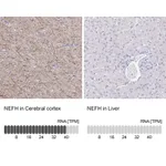 Atlas Antibodies Anti-NEFH Antibody