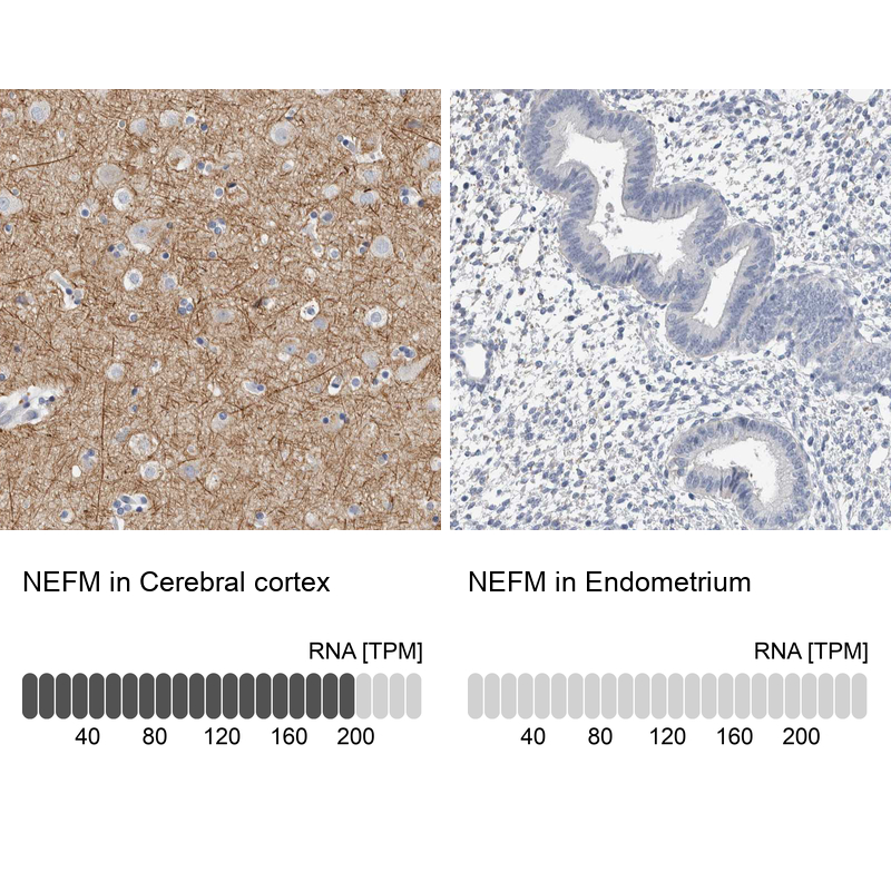 Atlas Antibodies Anti-NEFM Antibody
